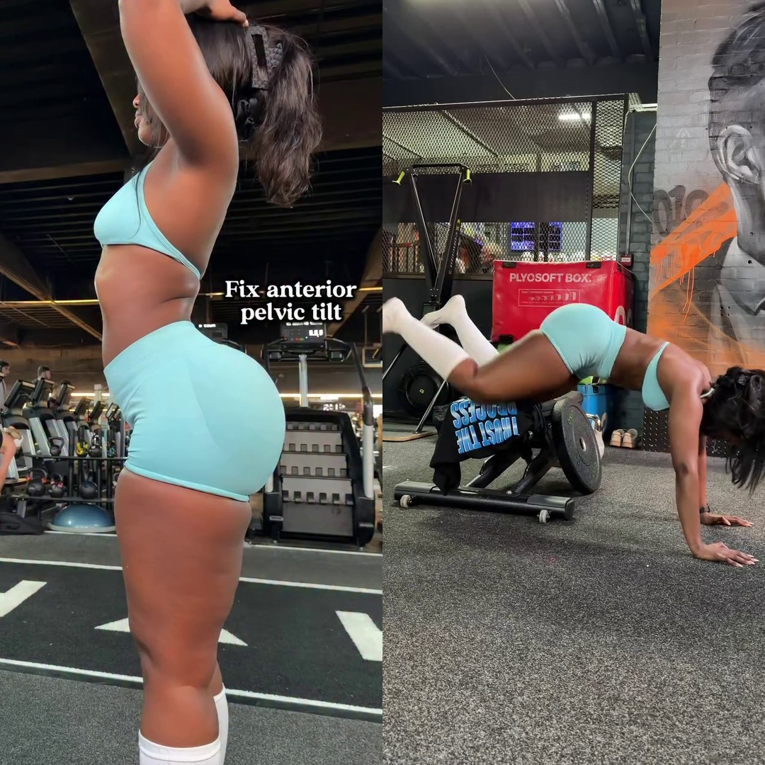 Fix Your Posture: Simple Moves to Correct Anterior Pelvic Tilt